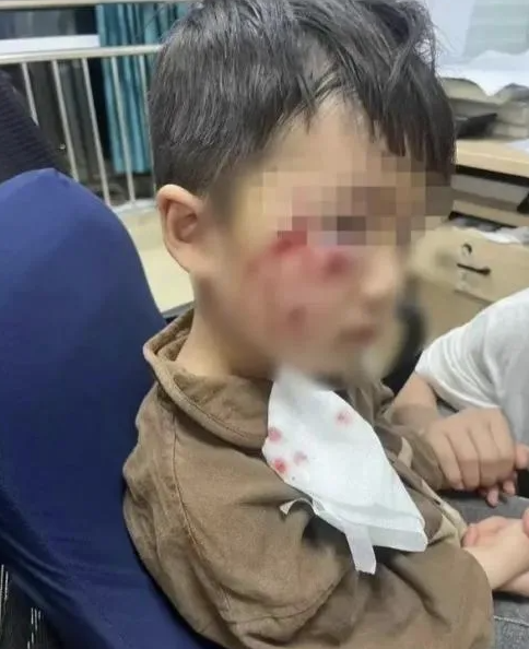 被瘋?cè)麤](méi)有“救命藥”，怎么辦？